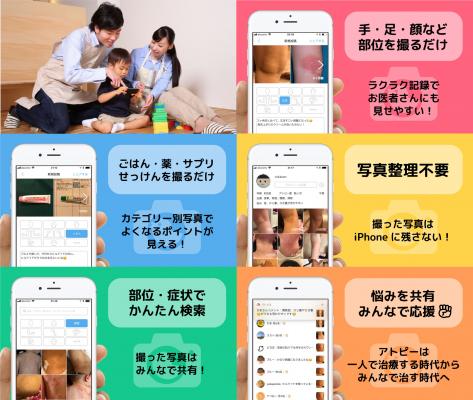 日本初の“アトピー治療見える化アプリ”をリリース。元アトピーのパパが無料iPhoneアプリ「アトピヨ」を開発！～ 夏汗の季節、手・顔・ごはん・薬を撮るだけでラクラク記録 ～