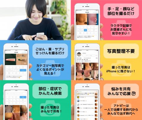 日本初の“アトピー治療見える化アプリ”が1000ダウンロード！元アトピーのパパが開発した無料iPhoneアプリ「アトピヨ」～ 夏汗の季節、手・顔・ごはん・薬を撮るだけでラクラク記録 ～